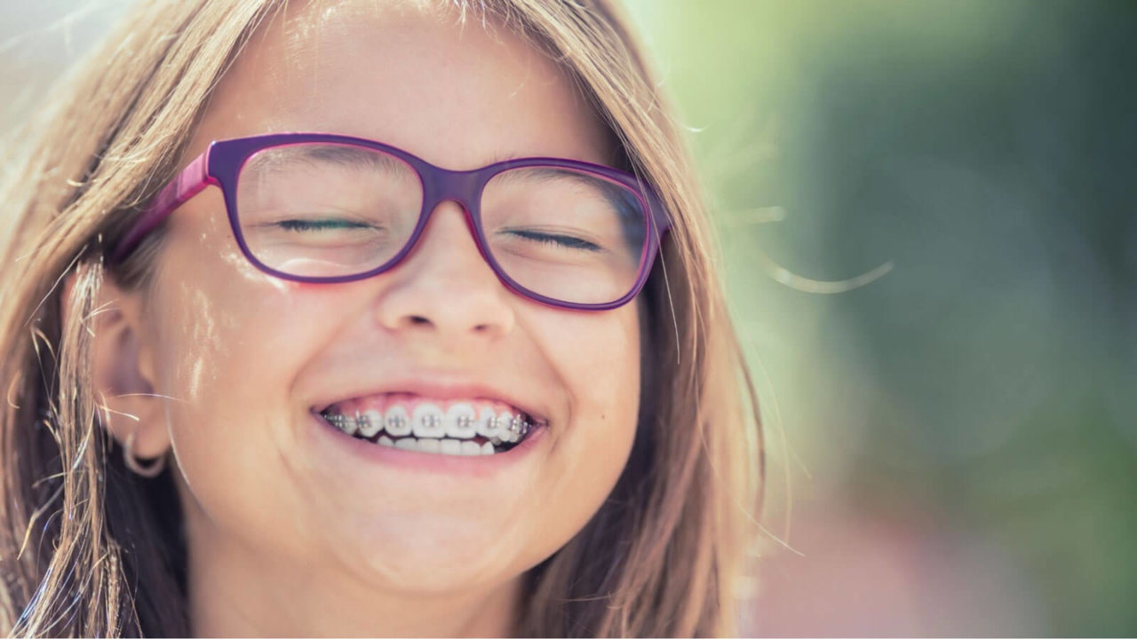 Average Cost Braces in Fort Worth, TX Fort Worth Orthodontic Specialists